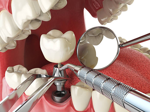 Best Emergency Treatment for Toothache in La Vista, NE